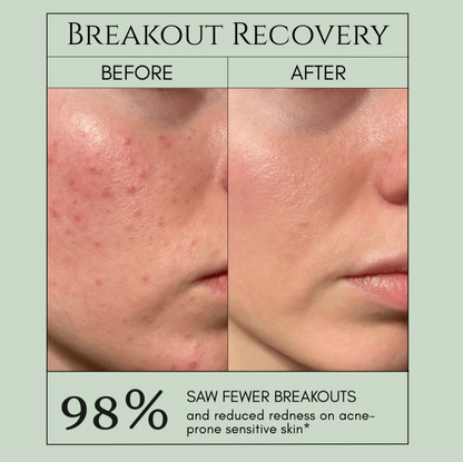 Holy Basil Bubble Mask